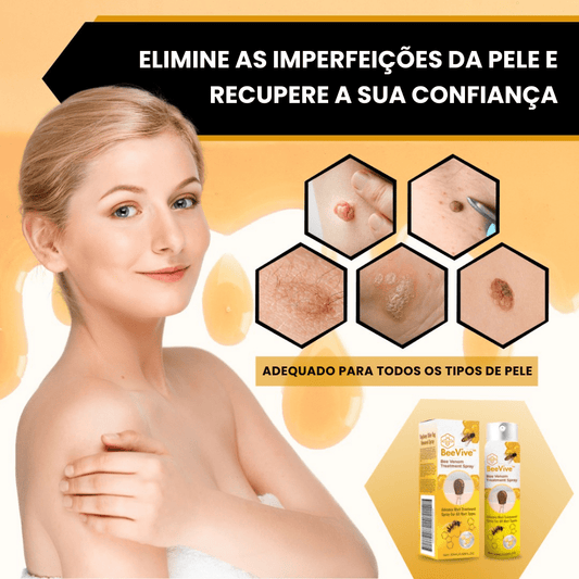 Ecoderm™ - Tratamiento Remove Verrugas